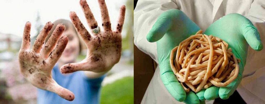يمكن للطفيليات أن تدخل الجسم من خلال الأيدي القذرة