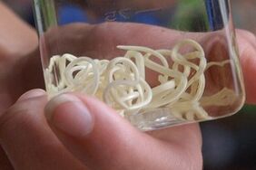 الطفيليات من جسم الإنسان